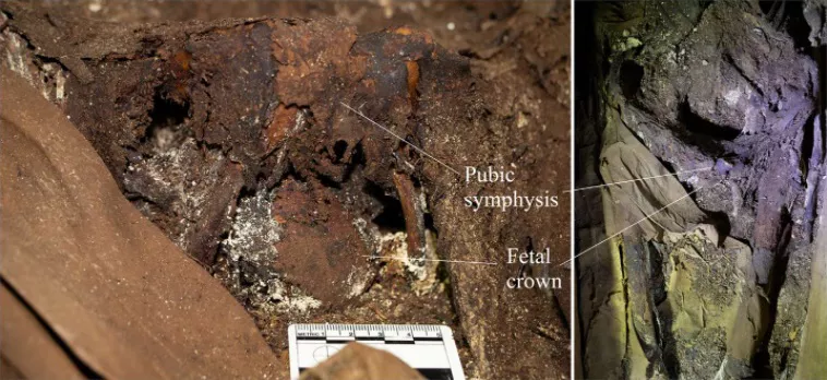 Mujer dio a luz muerta 2