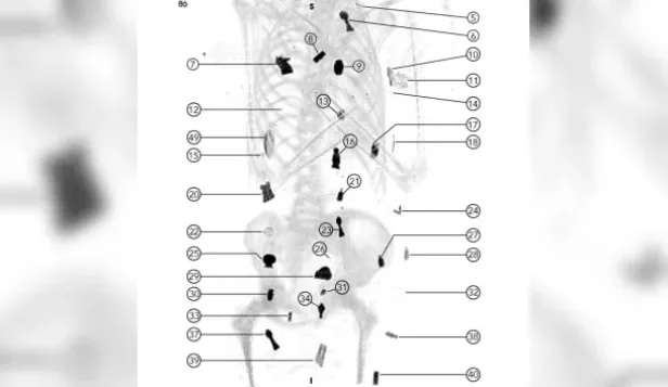 niño de oro momia amuletos