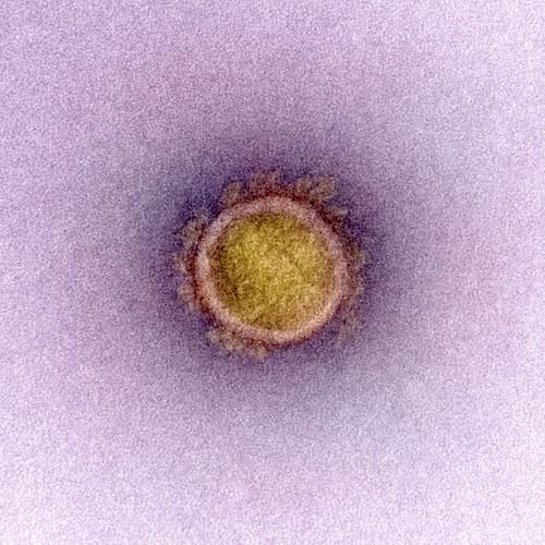 CoronavirusMicroscopio