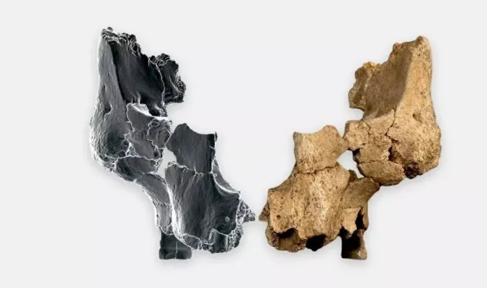 huesos del pómulo y el lado izquierdo de una mandíbula 2