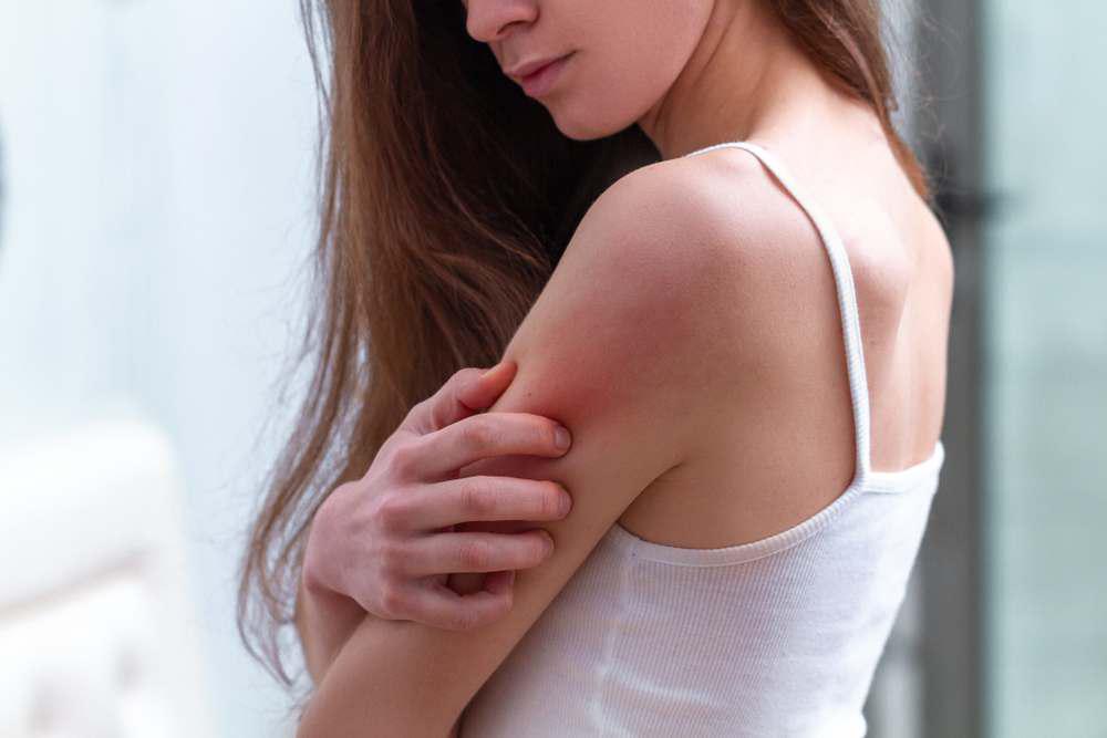 mujer-brazo-piel-irritada-comezon