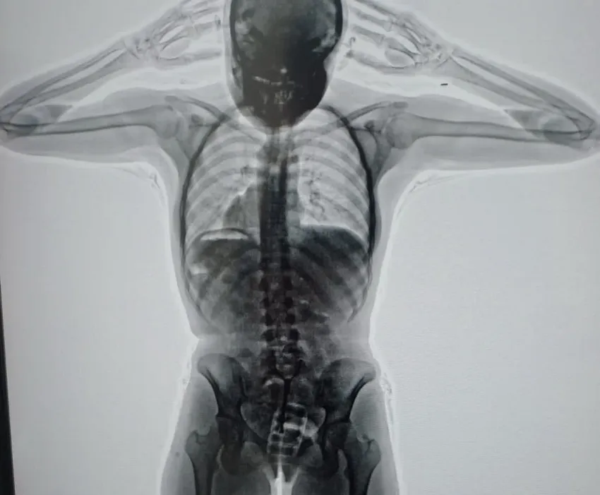 mula-ezeiza-cocaína-detención_ NA