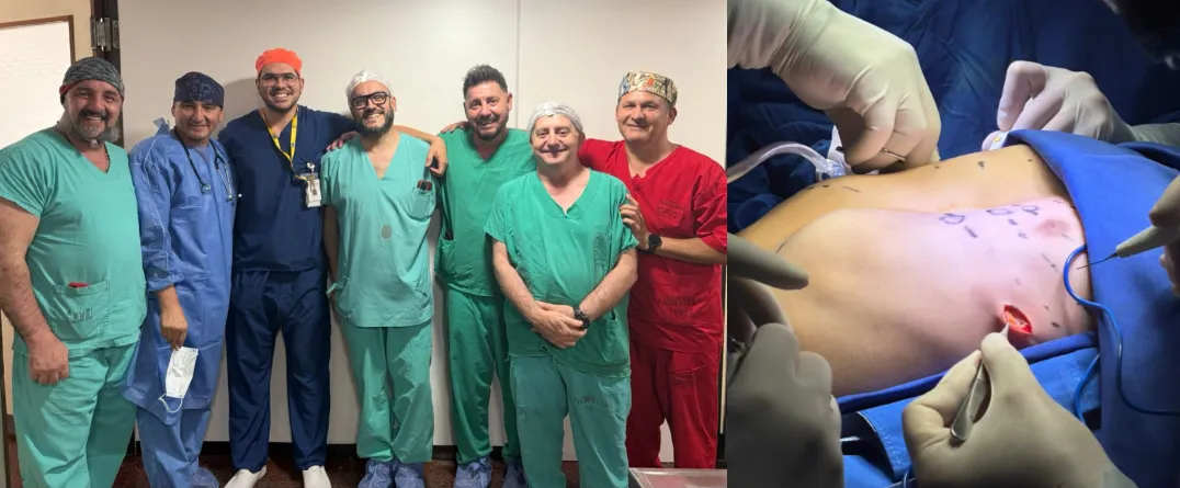 Hospital Infantil  pectus excavatum 2