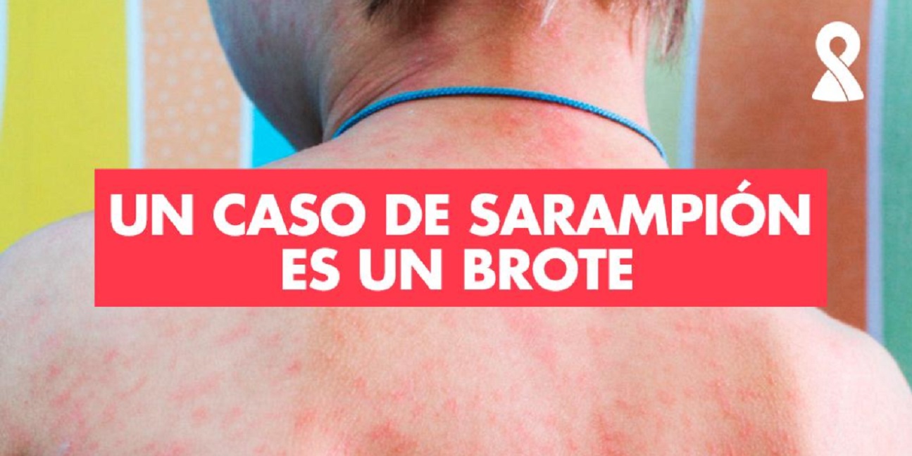 Sarampion brote