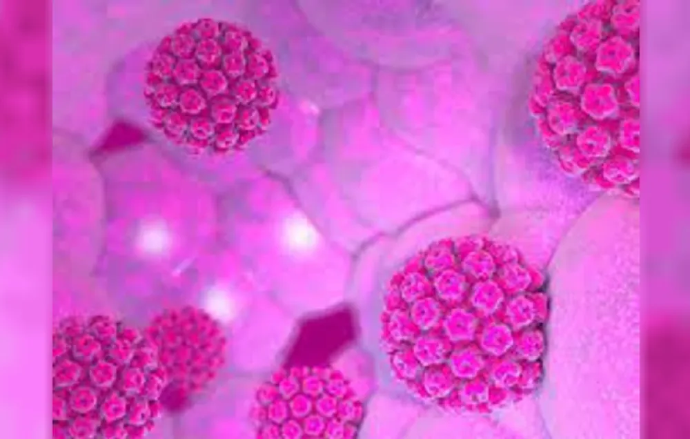 Virus del Papiloma Humano VPH