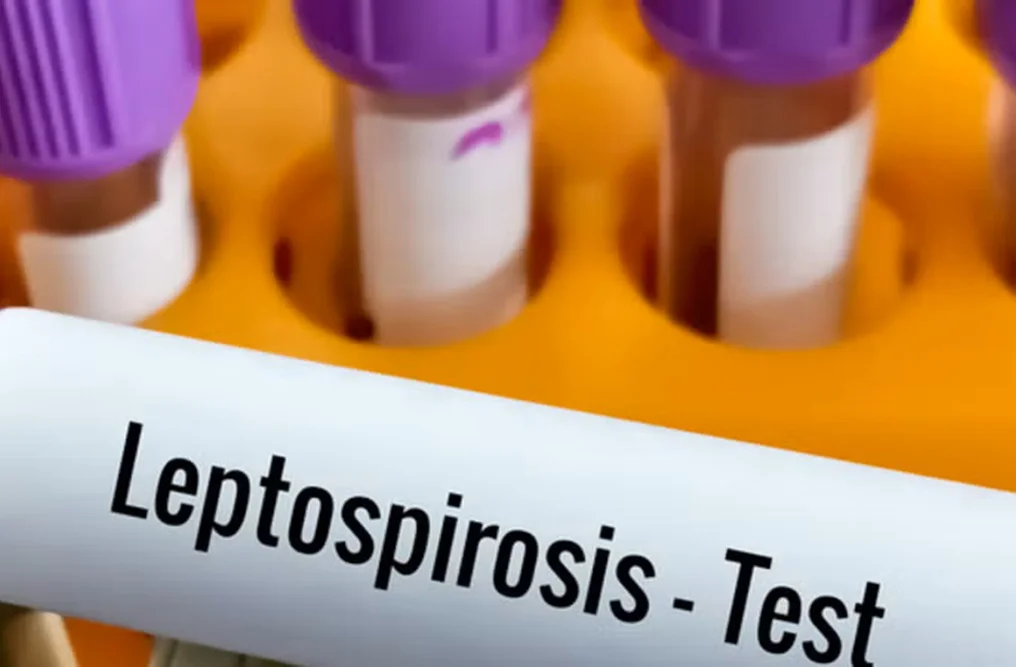leptospirosis
