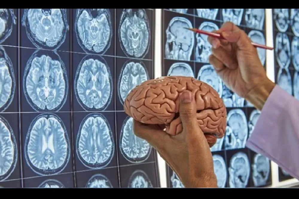 vacuna contra el tumor cerebral
