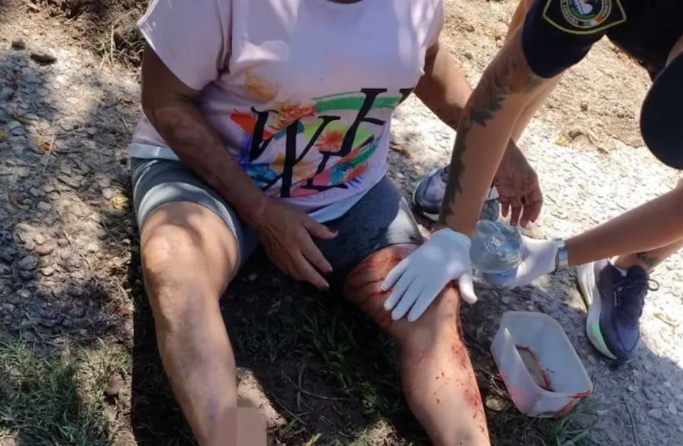 una mujer fue atacada por un perro