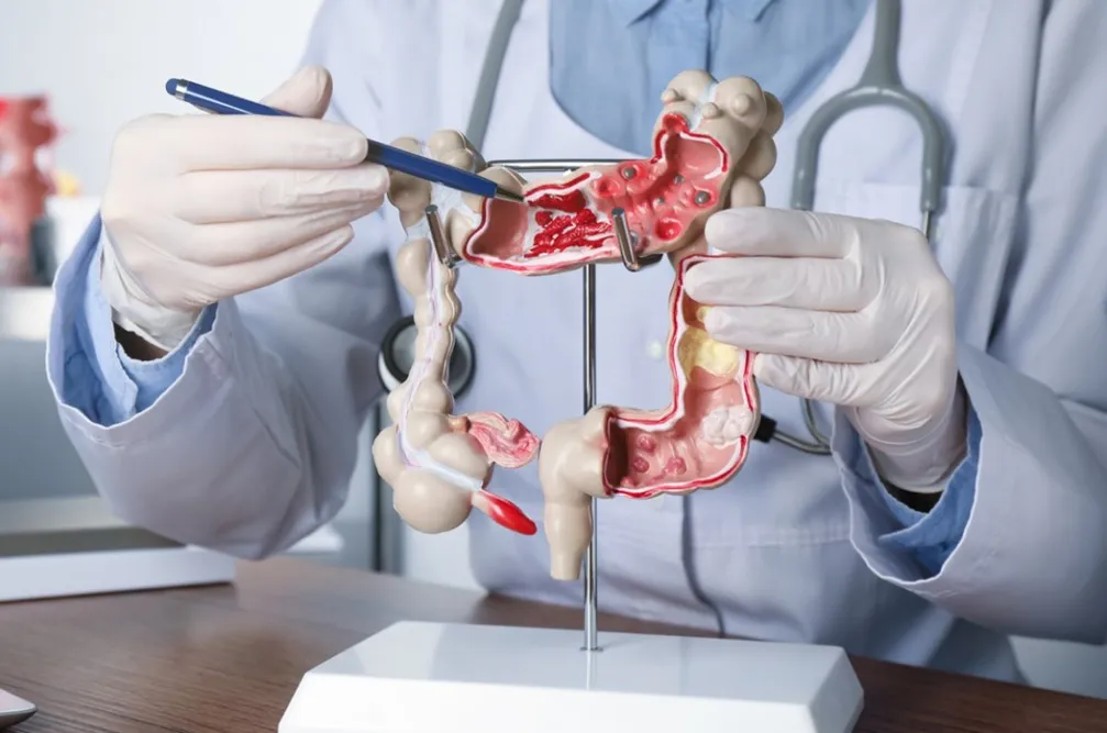 colon-model-1200x675-1