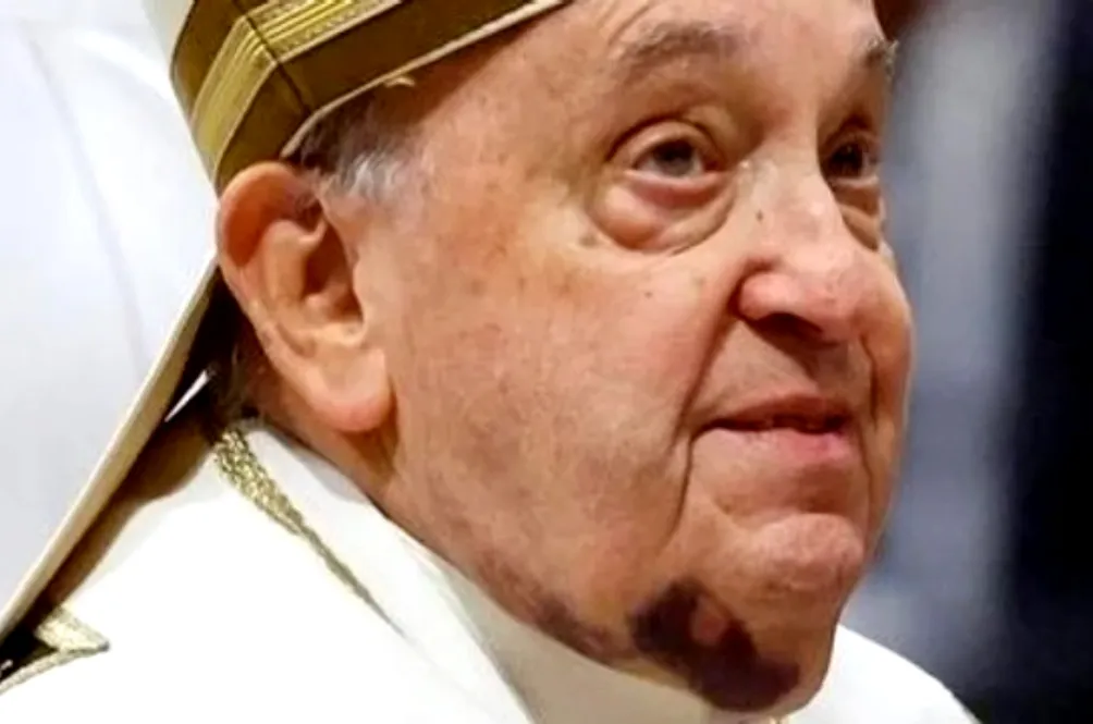 _Papa Francisco  Rostro hematoma